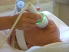 Arc kezelés menete